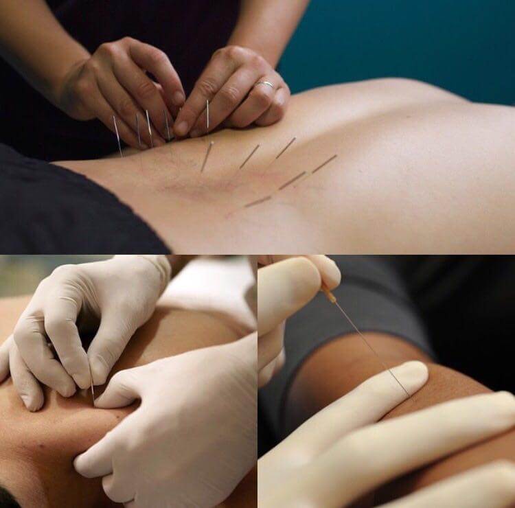 فیزیوتراپی مهرگان گوهردشت - دکتر من